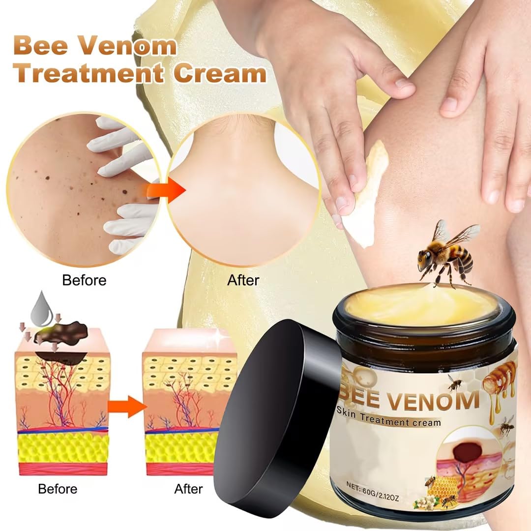 2Pcs Bee Venom Skin Treatment Cream, Bee Venom Comprehensive skincare Cream, 2025 New Professional Bee Venom Gel, Bee Venom Moisturizing Gel for All Body Parts/60g - Image 2