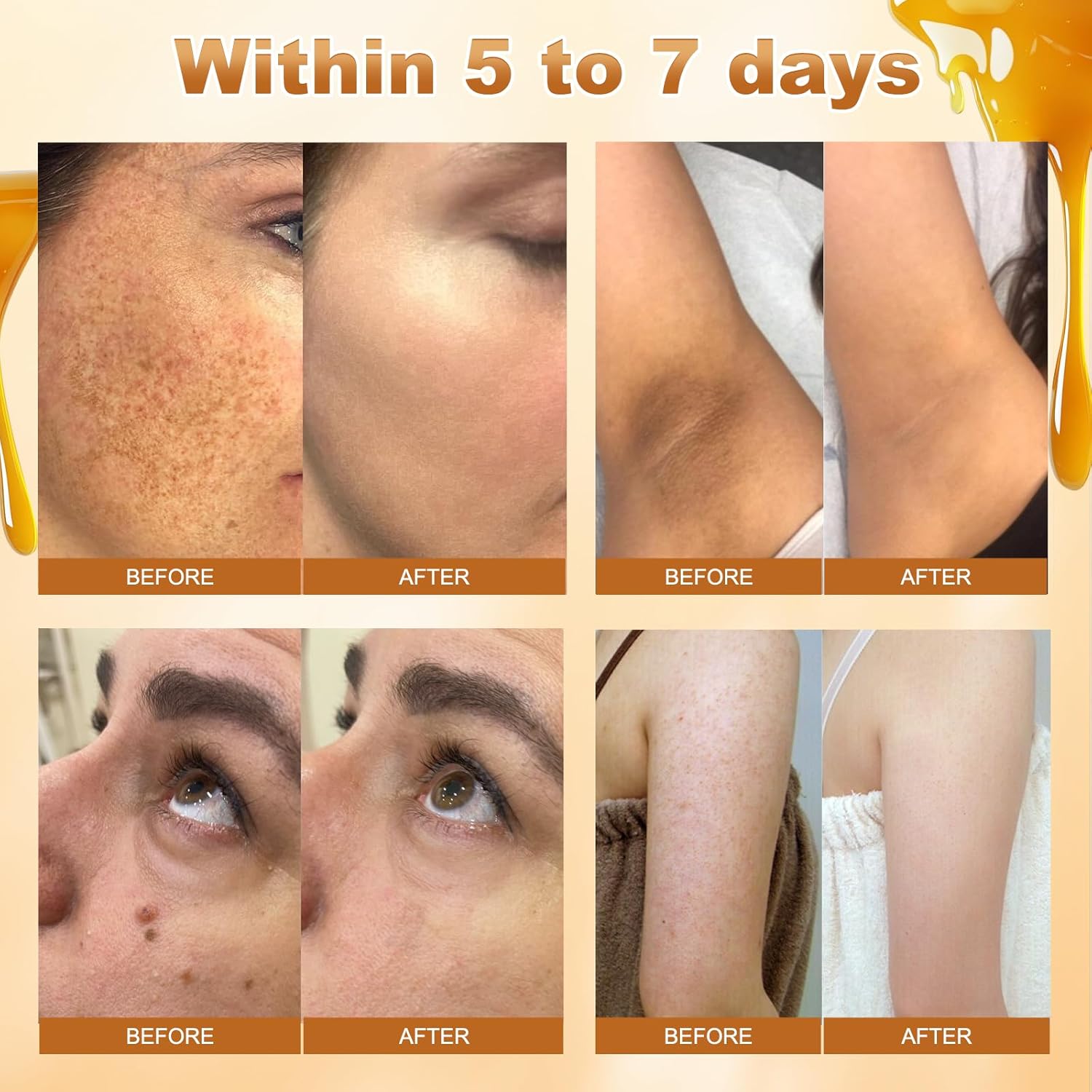 2Pcs Bee Venom Skin Treatment Cream, Bee Venom Comprehensive skincare Cream, 2025 New Professional Bee Venom Gel, Bee Venom Moisturizing Gel for All Body Parts/60g - Image 4