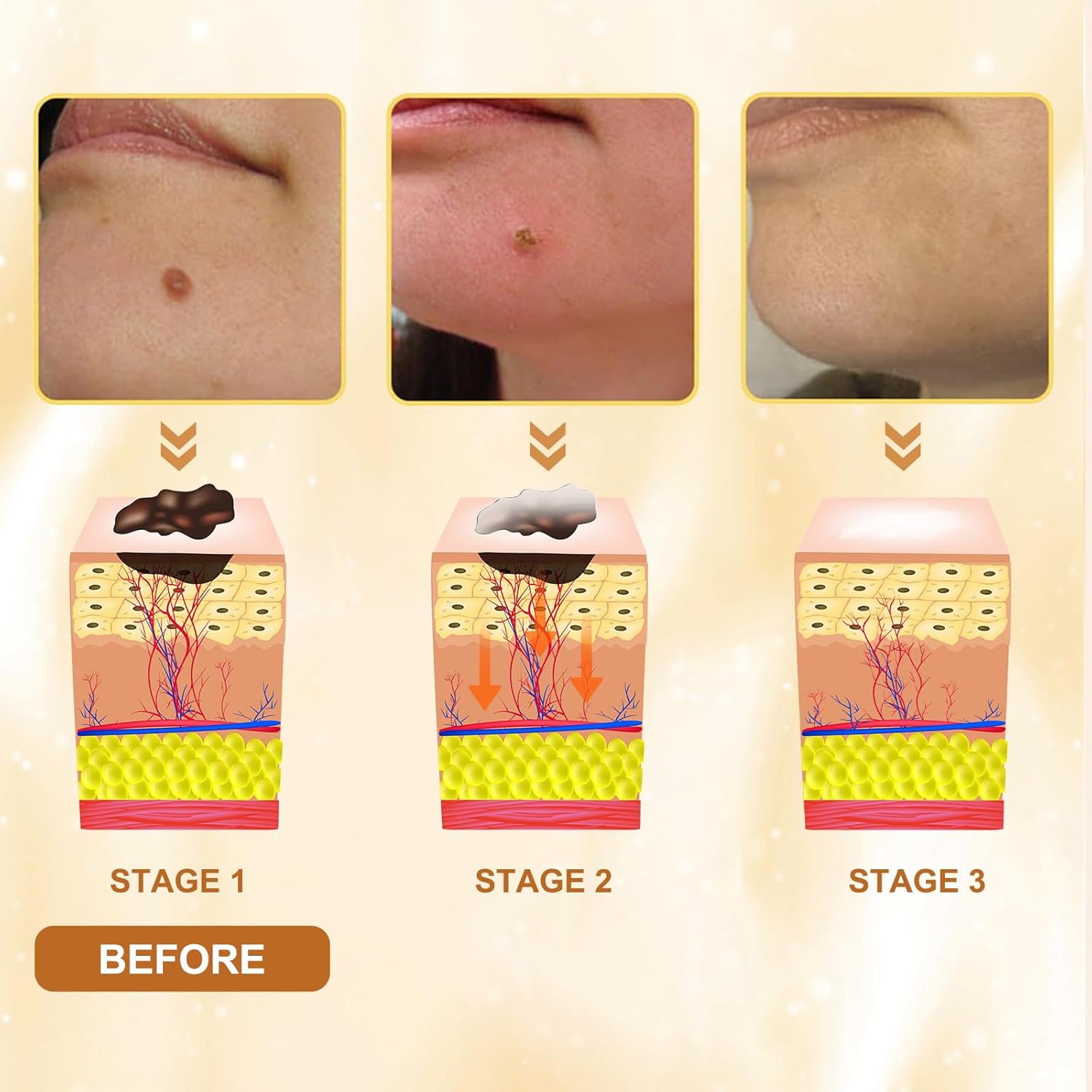 2Pcs Bee Venom Skin Treatment Cream, Bee Venom Comprehensive skincare Cream, 2025 New Professional Bee Venom Gel, Bee Venom Moisturizing Gel for All Body Parts/60g - Image 7