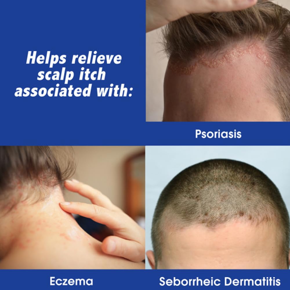 Scalpicin Scalp Itch Relief, 1.5 fl Oz. Maximum Strength (Pack of 6) - Image 4