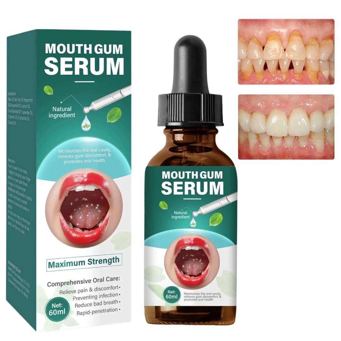 Gum Restore Drops, Gum Repair for Receding Gums & Stain Removal, Bad Breath Treatment for Adults(Dark Green, 2 Fl Oz)