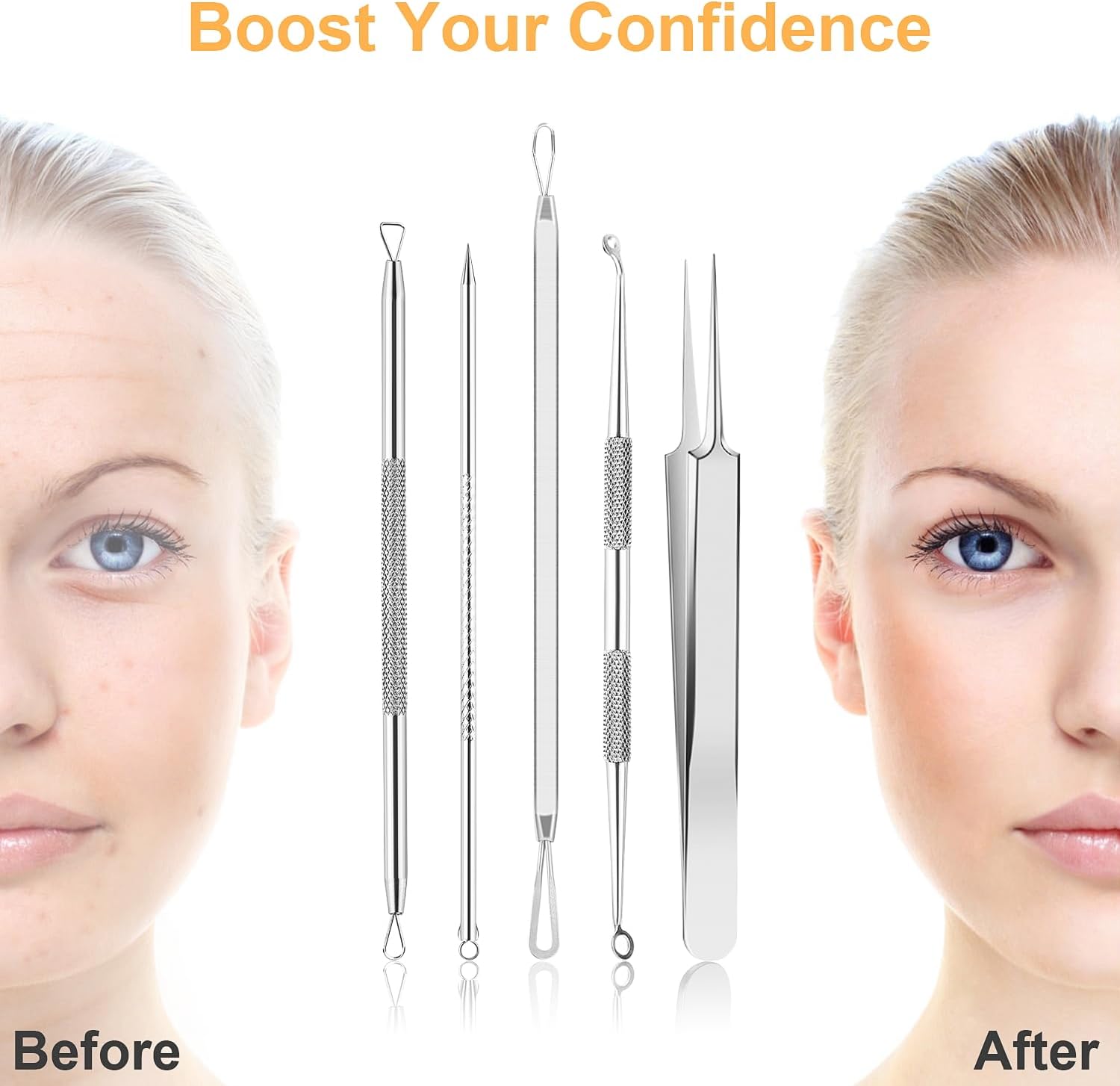 UUBAAR 9PCS Blackhead Remover Tools, Pimple Popper Tool Kit with 2 Tweezers, 304 Stainless Steel Comedone Extractor, 16 Precision Heads Face Nose Acne Zit Removal, Home Esthetician Use & Leather Case - Image 2