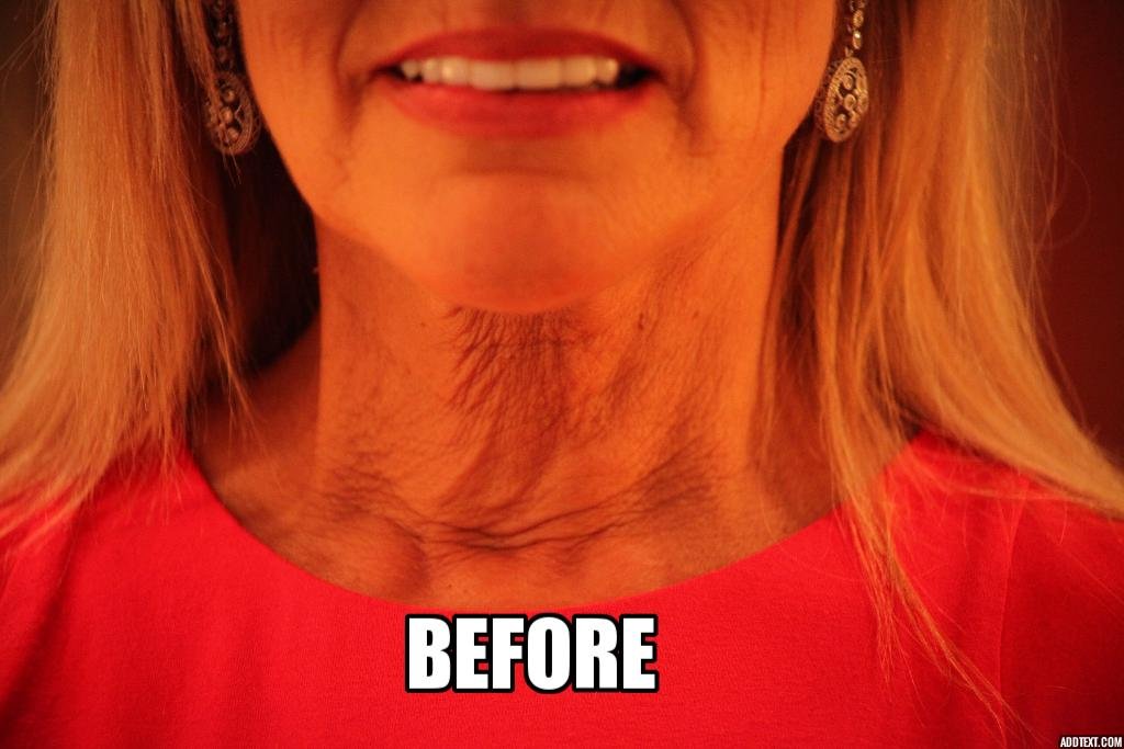 NeckTITE Magic - The Instant Neck Lift - Image 3