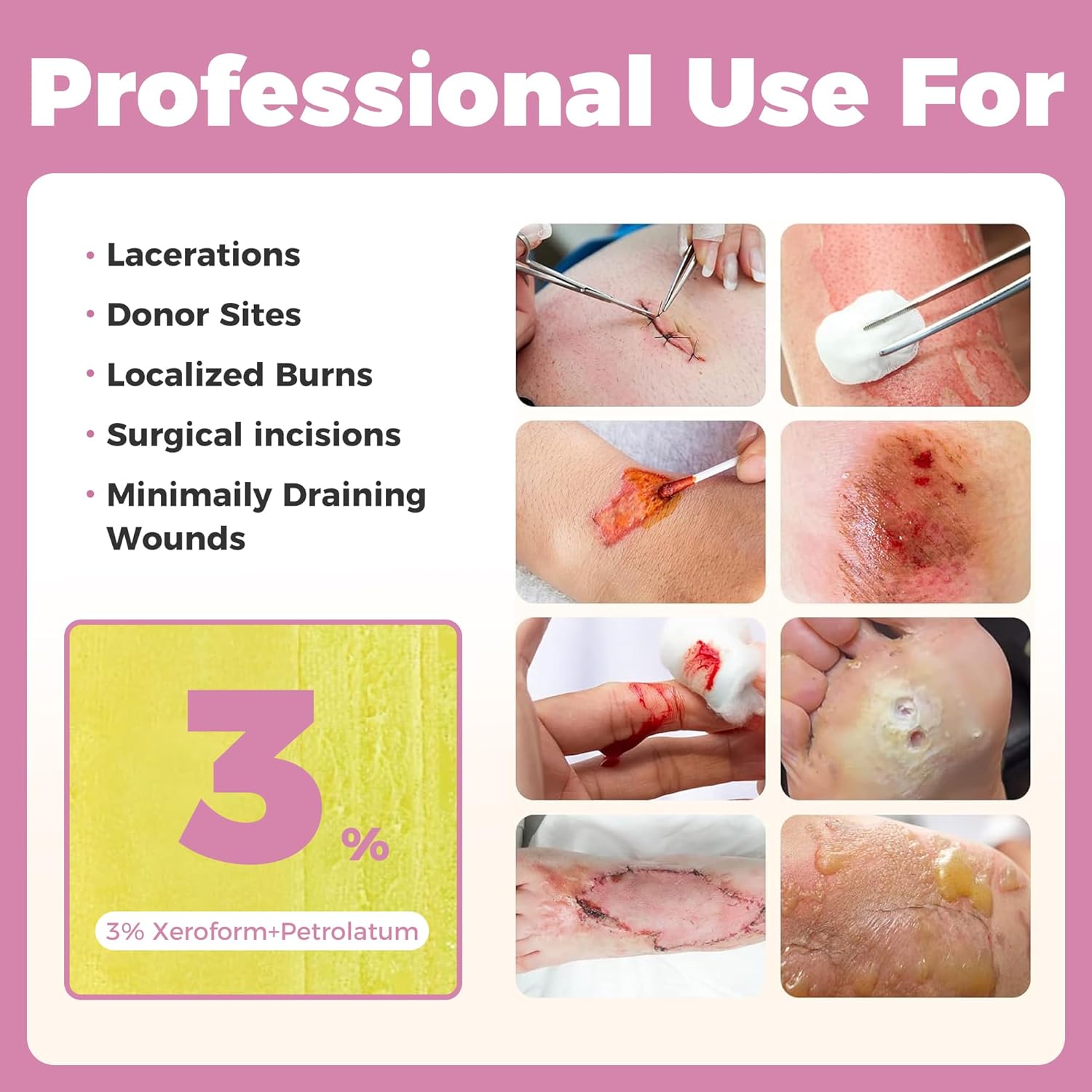 JUSORE Xeroform Petrolatum Dressing - FSA-HSA, 5"x9", Medical Non Stick Gauze Pads, Soft Mesh Gauze Patch for Wound Care, Burns, Lacerations, Skin Grafts & Surgical Incisions, 7 Individual Pack - Image 5