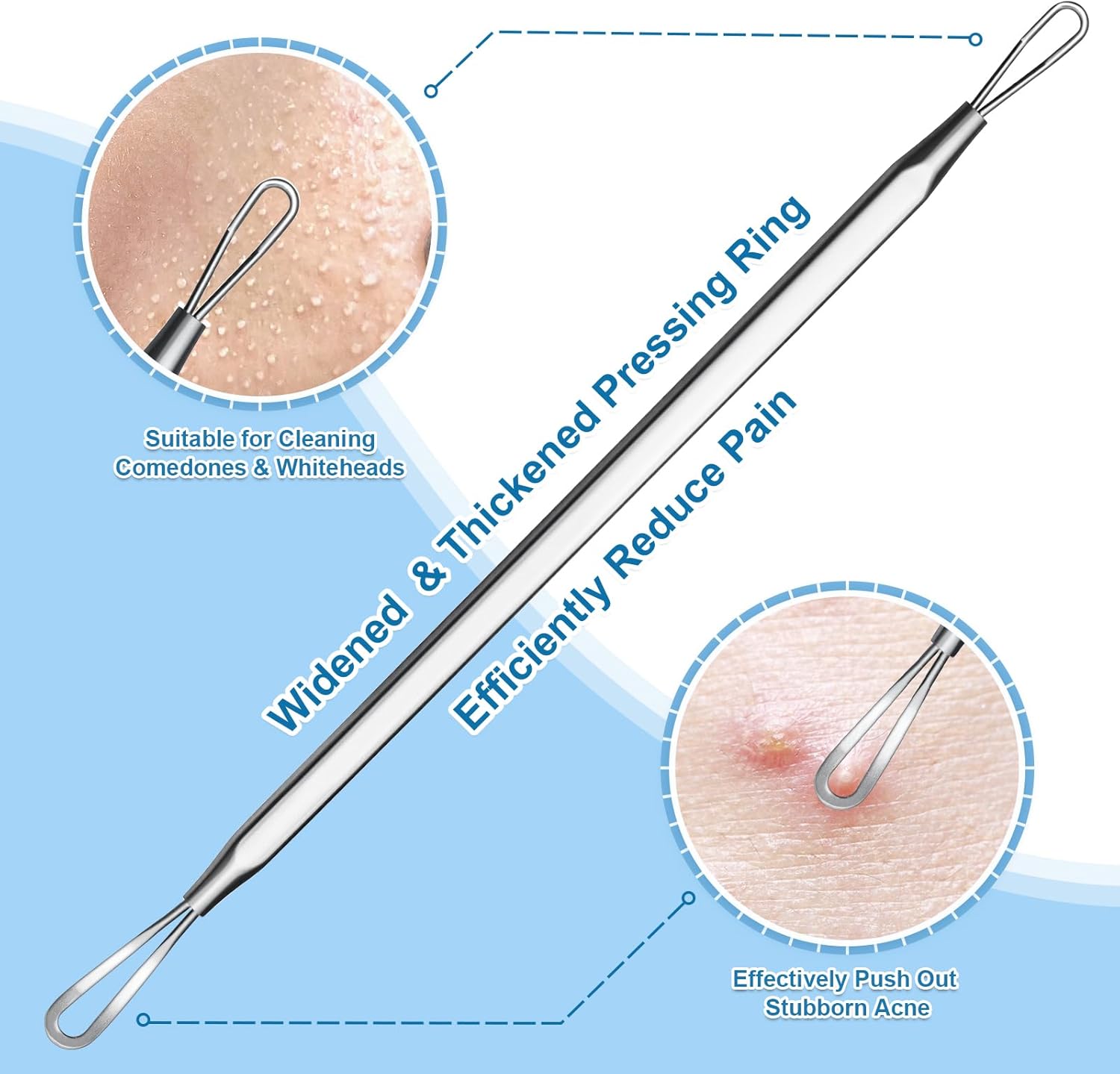 Stainless Steel Blackhead Remover, Pimple Extractor, Pimple Popper, Comedone Extractor, Surgical Grade Acne Treatment Tool, 3rd Generation Blemish Removal Kit for Face, Nose, T-Zone, 2Pcs - Image 3