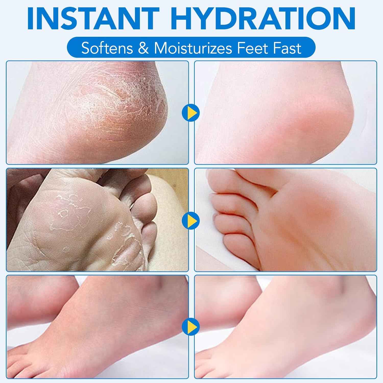 Uruses Urea Cream 60% plus Salicylic Acid 2% Urea Foot Care Stick, Foot Cream for Foot Callus Remover, Feet Moisturizer Stick for Dry Cracked Heels, Hands, Knees, Hydrating Heel Balm, Easy To Use - Image 7