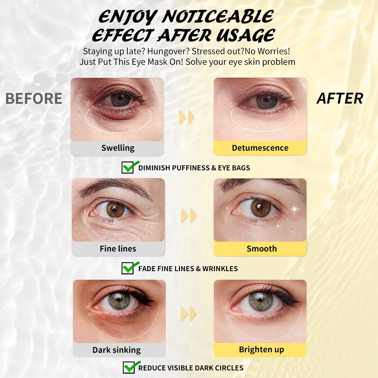 Maskiss Under Eye Patches (30 Pairs), Hyaluronic Acid Eye Masks for Dark Circles Puffy Eyes Undereye Bags, Collagen Eye Patches for Wrinkles and Hydrate, Skin Care Gift for Her - Image 3