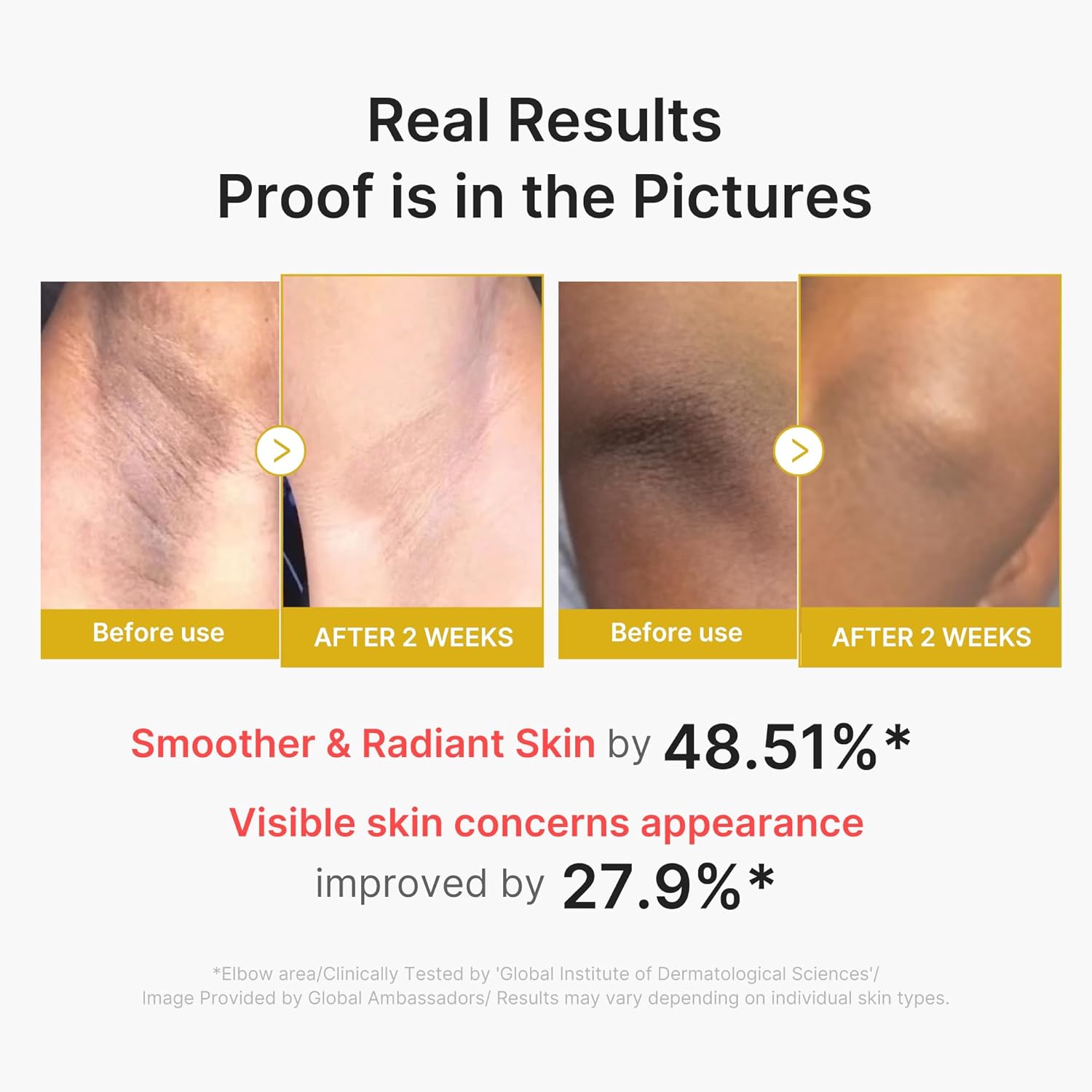 medicube Body Peel Shot with Kojic Acid and Turmeric | Gentle Body Brightening & Exfoliating Serum with BHA, LHA & PHA for Dead Skin Cells, Uneven Looking Skin & Excess Sebum | 9.46 fl.oz - Image 5