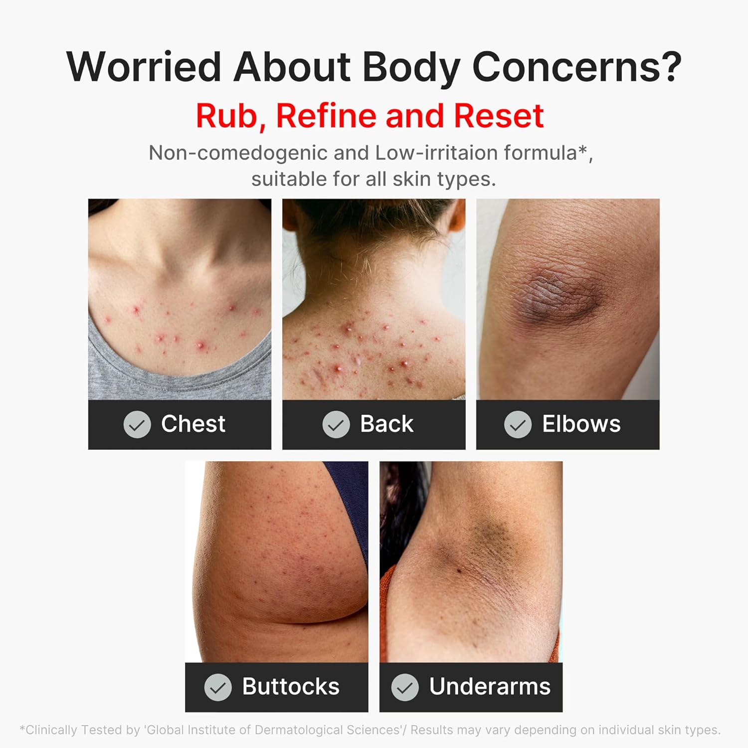 medicube Body Peel Shot with Kojic Acid and Turmeric | Gentle Body Brightening & Exfoliating Serum with BHA, LHA & PHA for Dead Skin Cells, Uneven Looking Skin & Excess Sebum | 9.46 fl.oz - Image 4