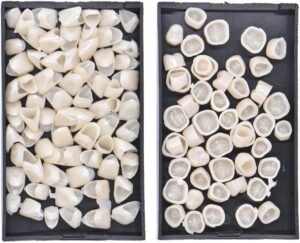 2 Box Dental Temporary Crown Veneer...